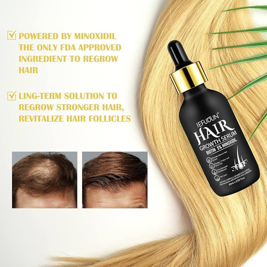 5% Minoxidil Hair Growth Serum