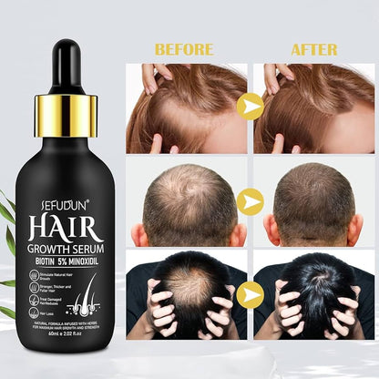 5% Minoxidil Hair Growth Serum