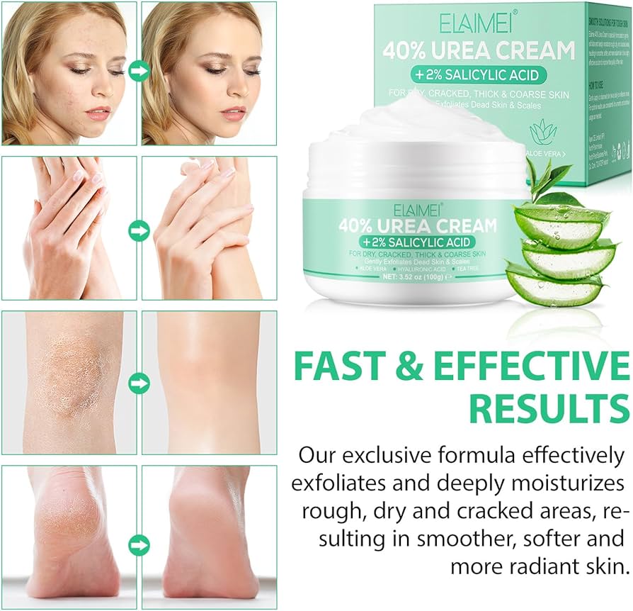 Urea Foot Cream Deep Moisturising 100 g
